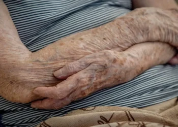 doença de Parkinson, tratamento medicamentoso, doença neurodegenerativa;